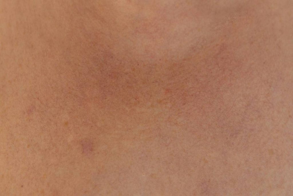 Does Collagen Supplements Reduce Wrinkles? A Science-Backed Deep Dive