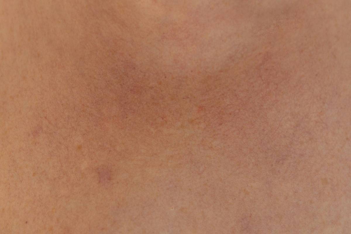Does Collagen Supplements Reduce Wrinkles? A Science-Backed Deep Dive